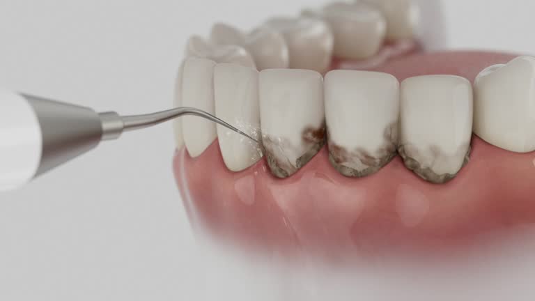 Reliable Teeth Whitening contractor in Muskegon County County, MI by Dentist Open Now